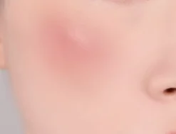 Banila Co Romantic Blush Lip & Cheek 04 Flora