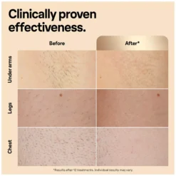 Braun IPL Silk·expert Pro 5 At Home Hair Removal With Pouch 1 Head PL5052