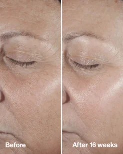 CliniqueSmart Clinical Repair Wrinkle Correcting Serum 75 ml