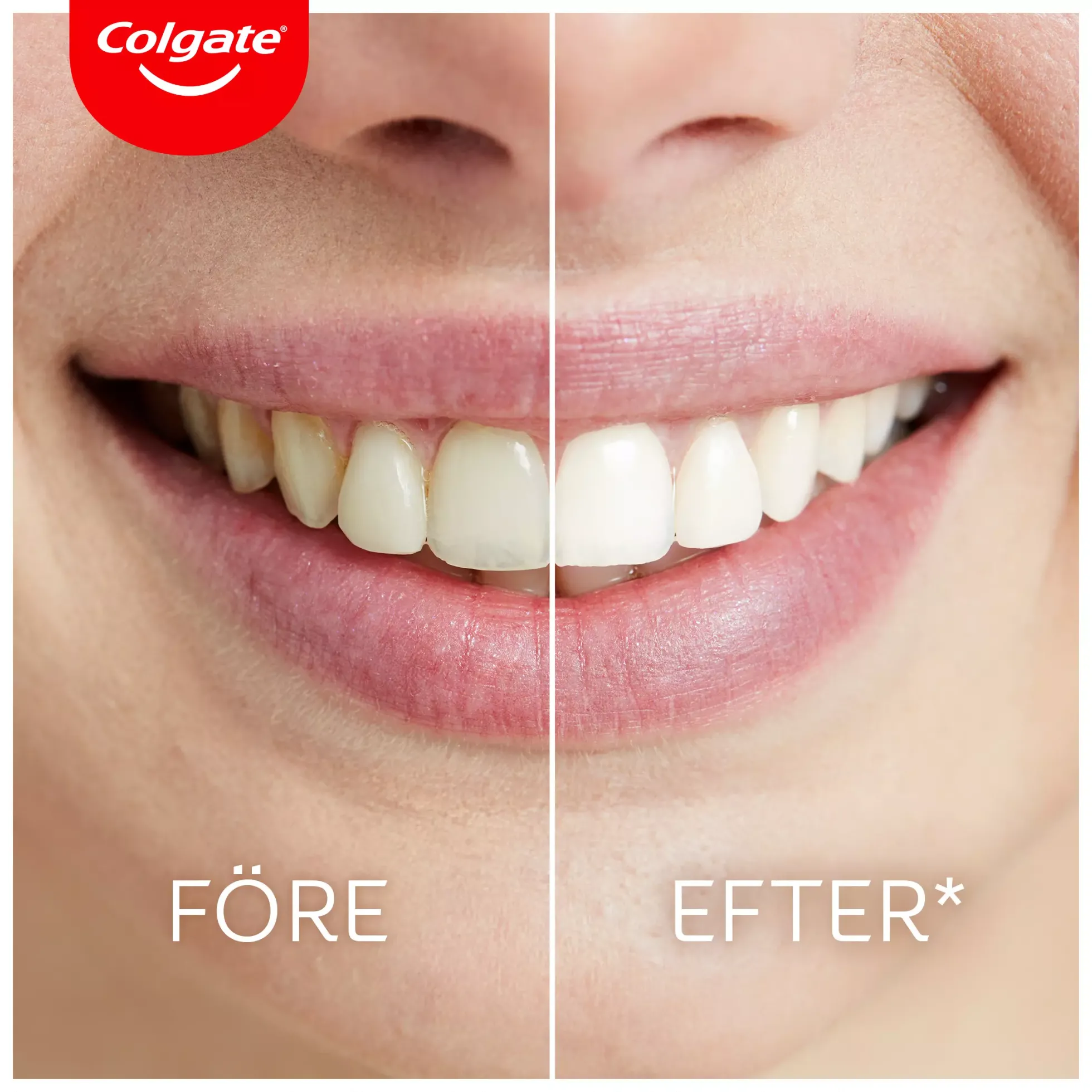 Colgate Colgate Max White Ultimate LED kit