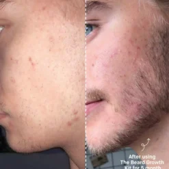Copenhagen GroomingBeard The Beard Growth Kit
