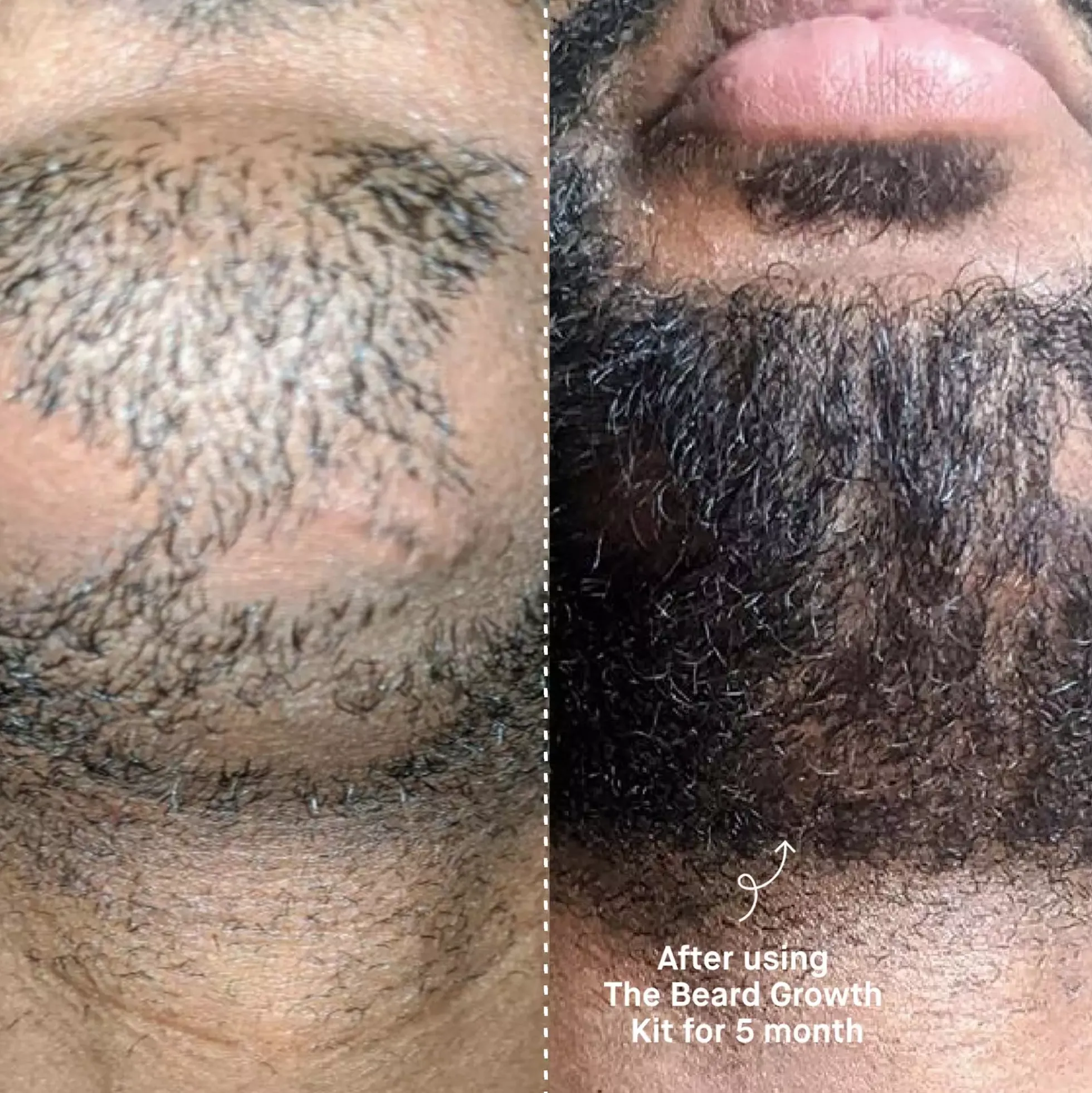 Copenhagen GroomingBeard The Beard Growth Kit