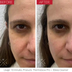 Dr. Levy ThermoGlow Pro 113 g