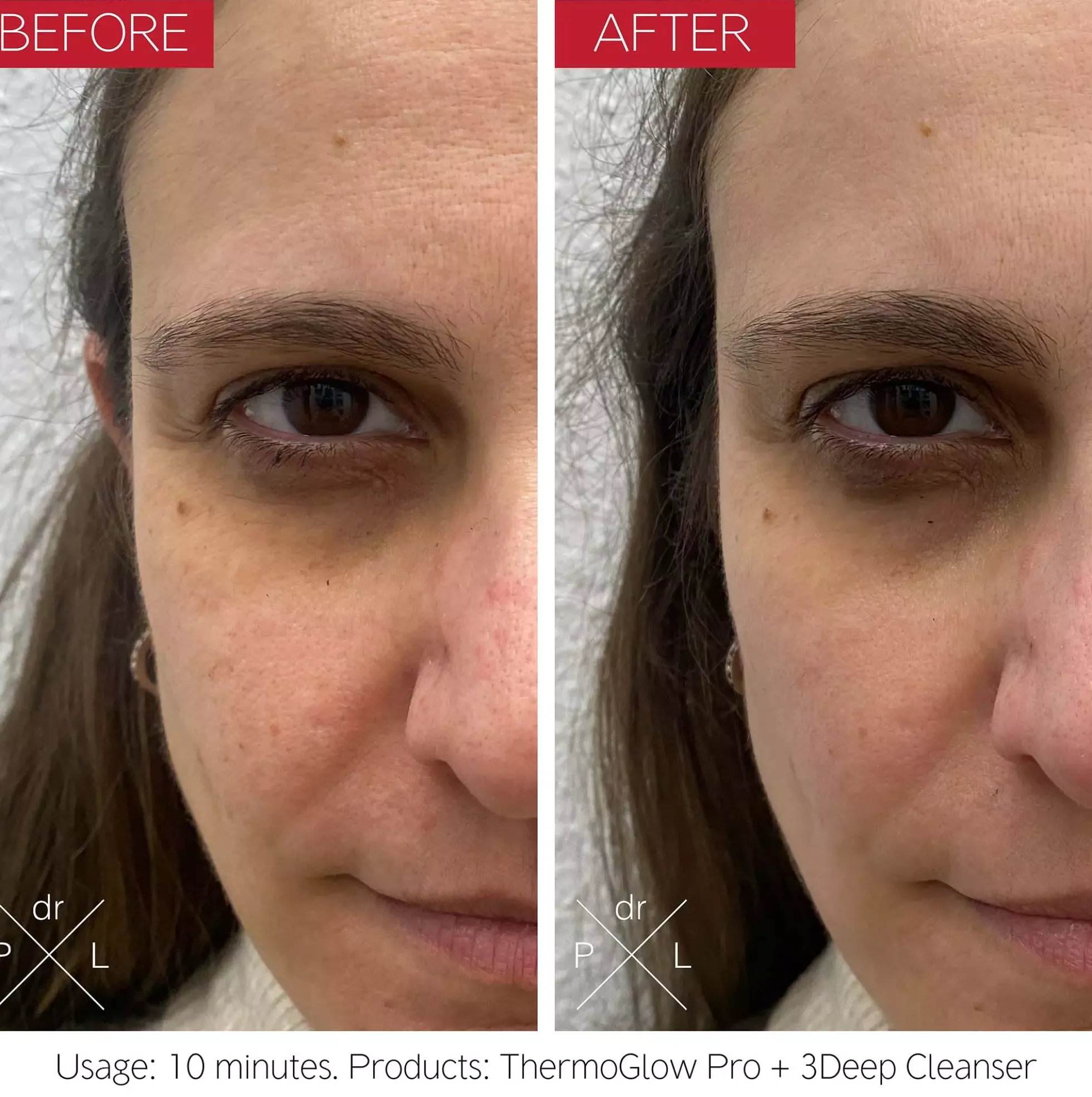 Dr. Levy ThermoGlow Pro 113 g