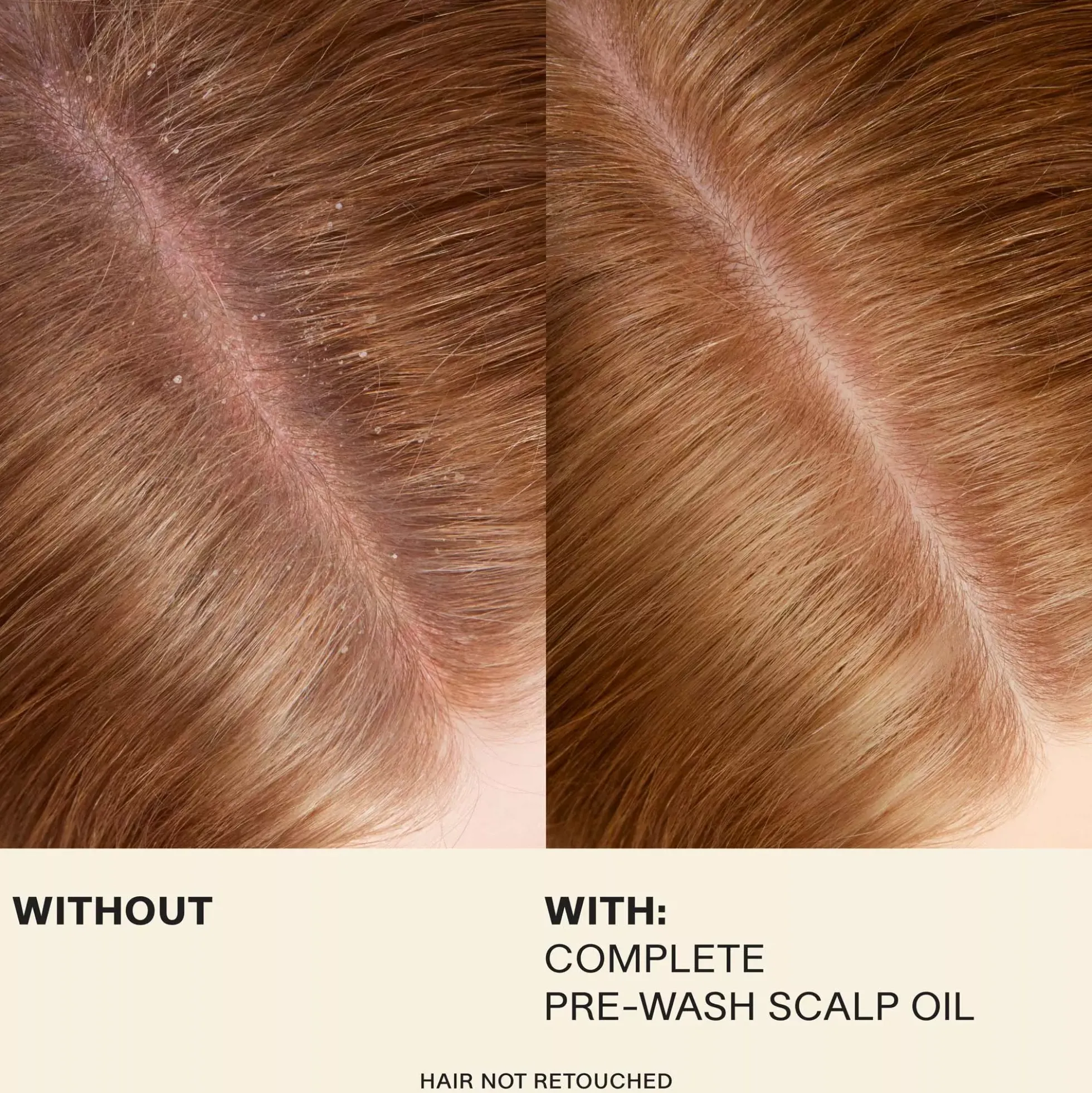 JVN Complete Pre-Wash Scalp Oil 50 ml