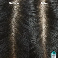 L'Oréal ProfessionnelScalp Advanced Professional Shampoo 300 ml