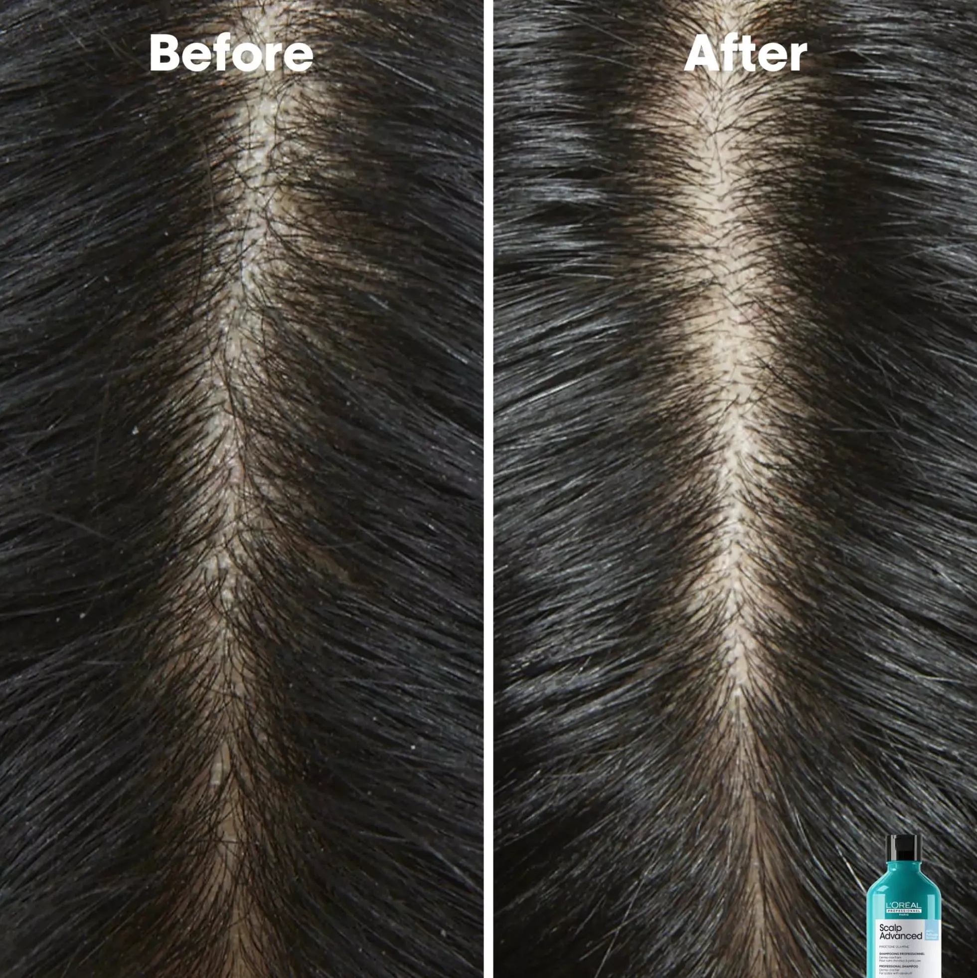 L'Oréal ProfessionnelScalp Advanced Professional Shampoo 300 ml