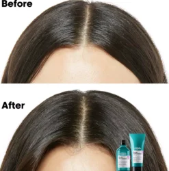 L'Oréal ProfessionnelScalp Advanced Anti-Discomfort Shampoo Refill