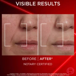 Loreal ParisRevitalift Laser Tri-Peptides Serum 30 ml, Laser Day Cream 50 ml & Laser Eye Bag Instant Eraser 15 ml