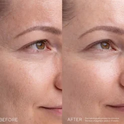 Mádara Kojic Alternative Pigment Serum 30 ml