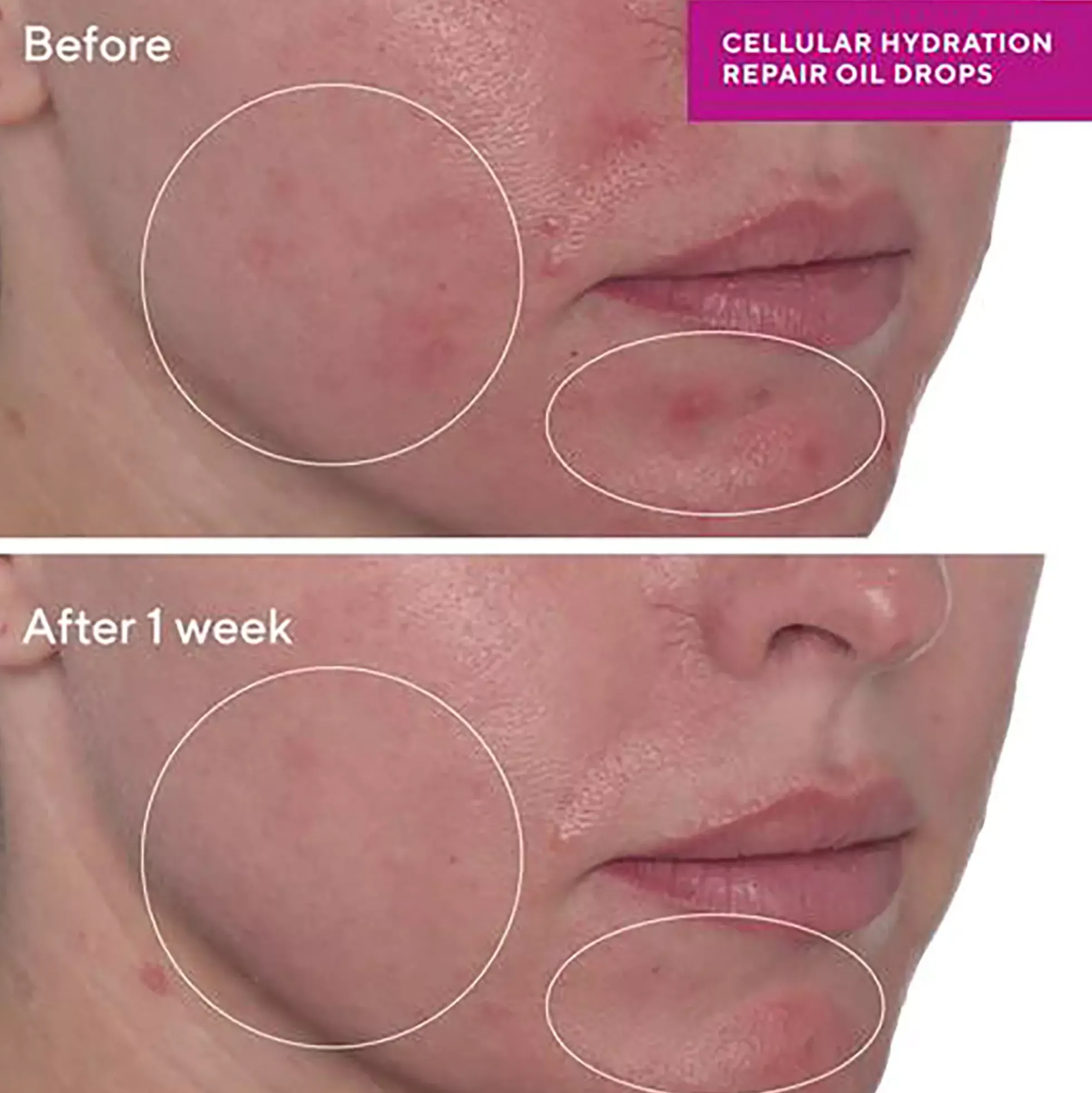 Murad Cellular Hydration Repair Oil Drops 30 ml