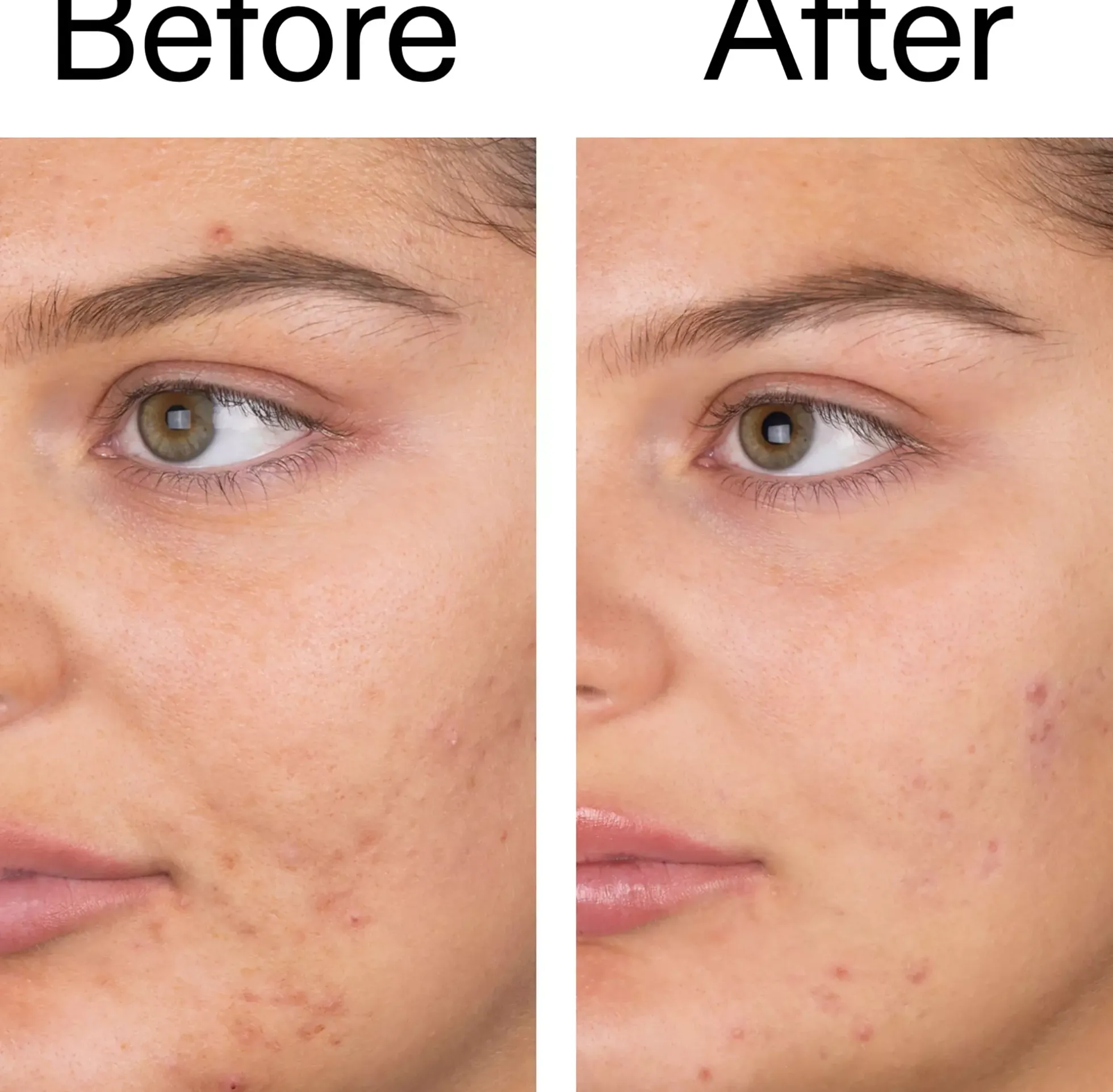 The Inkey List Salicylic Acid Cleanser 150 ml