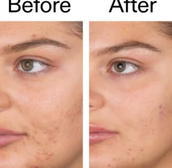 The Inkey List Salicylic Acid Cleanser 60 ml
