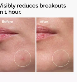 The Ordinary Sulfur 10% Powder-to-Cream Concentrate 5 g