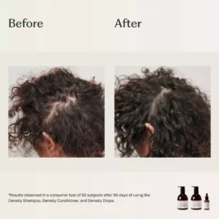 Under Your Skin Density Drops Boosts Thickness & Density 30 ml